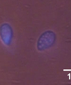 Tetrahymena pyriformis viewed by fluorescence microscopy Photo: Dorothea Gilbert.